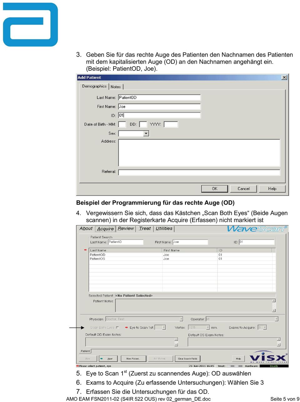 Vergewissern Sie sich, dass das Kästchen Scan Both Eyes (Beide Augen scannen) in der Registerkarte Acquire (Erfassen) nicht markiert ist 5.