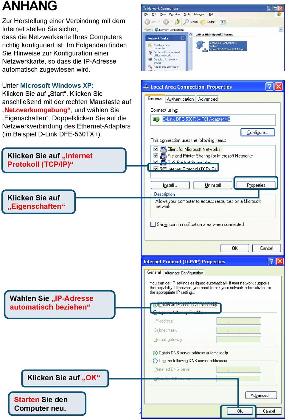 Unter Microsoft Windows XP: Start. Klicken Sie anschließend mit der rechten Maustaste auf Netzwerkumgebung, und wählen Sie Eigenschaften.