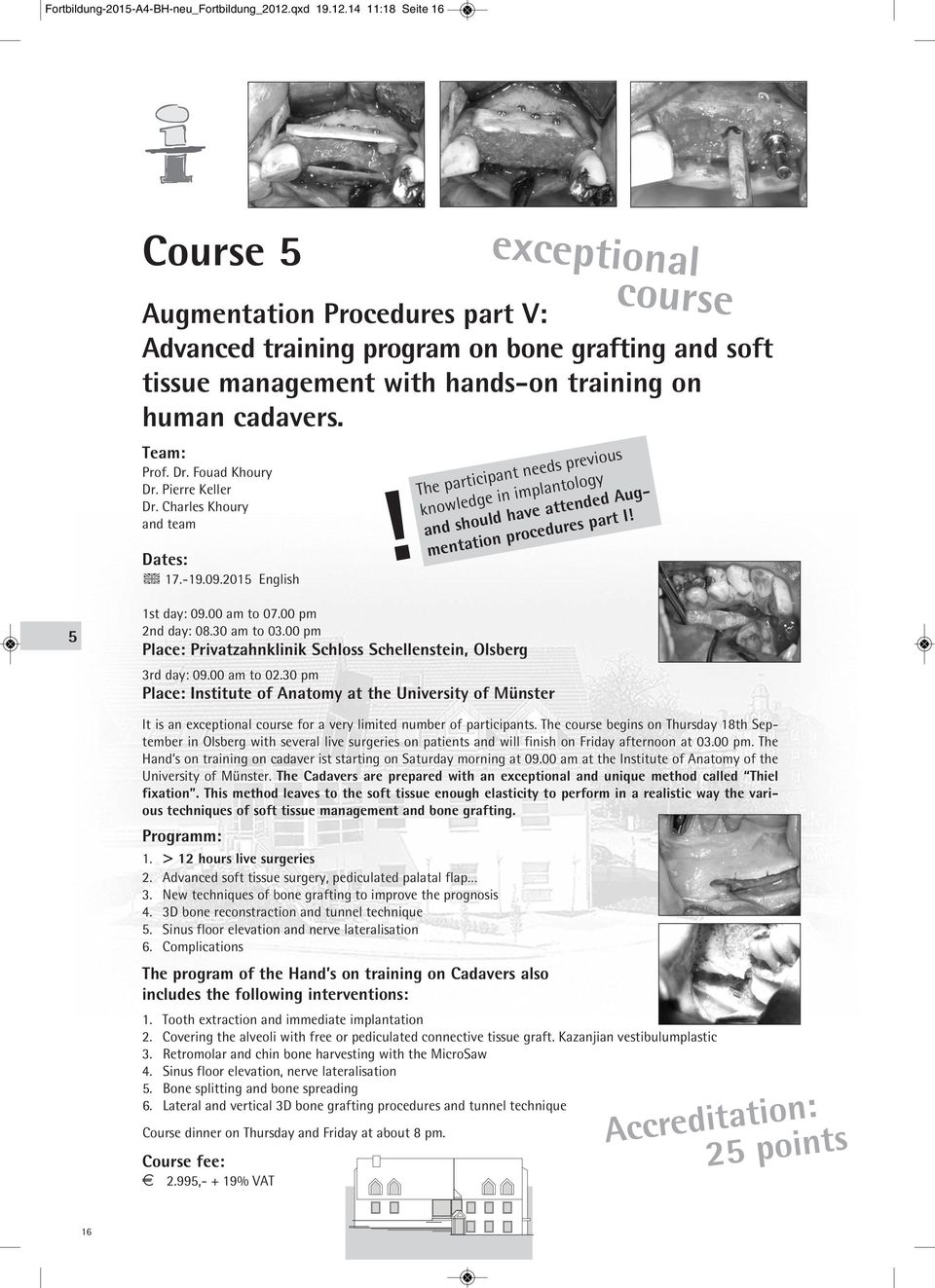 Fouad Khoury Dr. Pierre Keller Dr. Charles Khoury and team Dates: 17.-19.09.2015 English exceptional course The participant needs previous knowledge in implantology and should have attended Aug-!