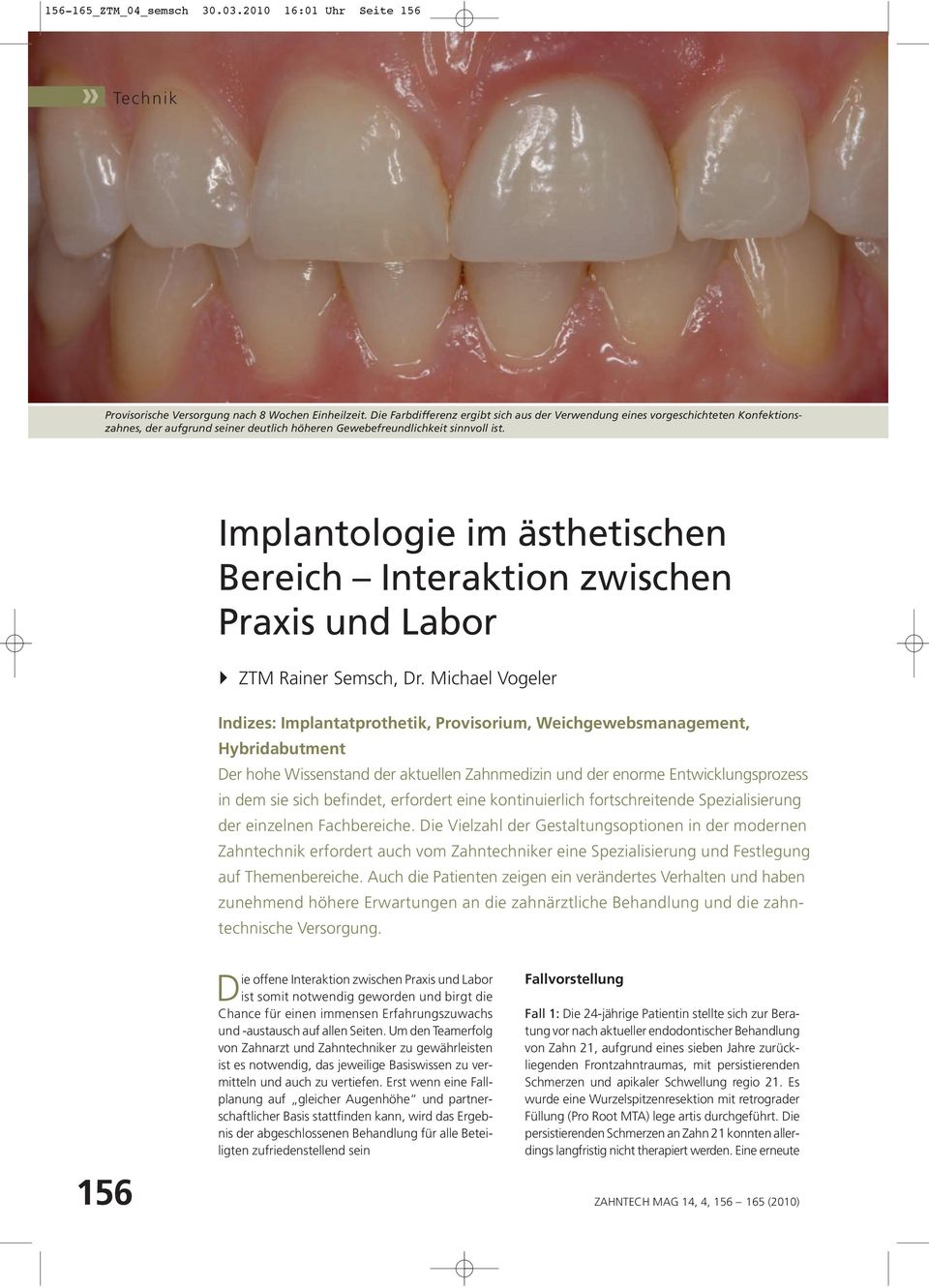 Implantologie im ästhetischen Bereich Interaktion zwischen Praxis und Labor ZTM Rainer Semsch, Dr.