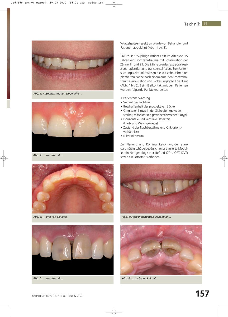Die Zähne wurden extraoral resiziert, replantiert und transdental fixiert.