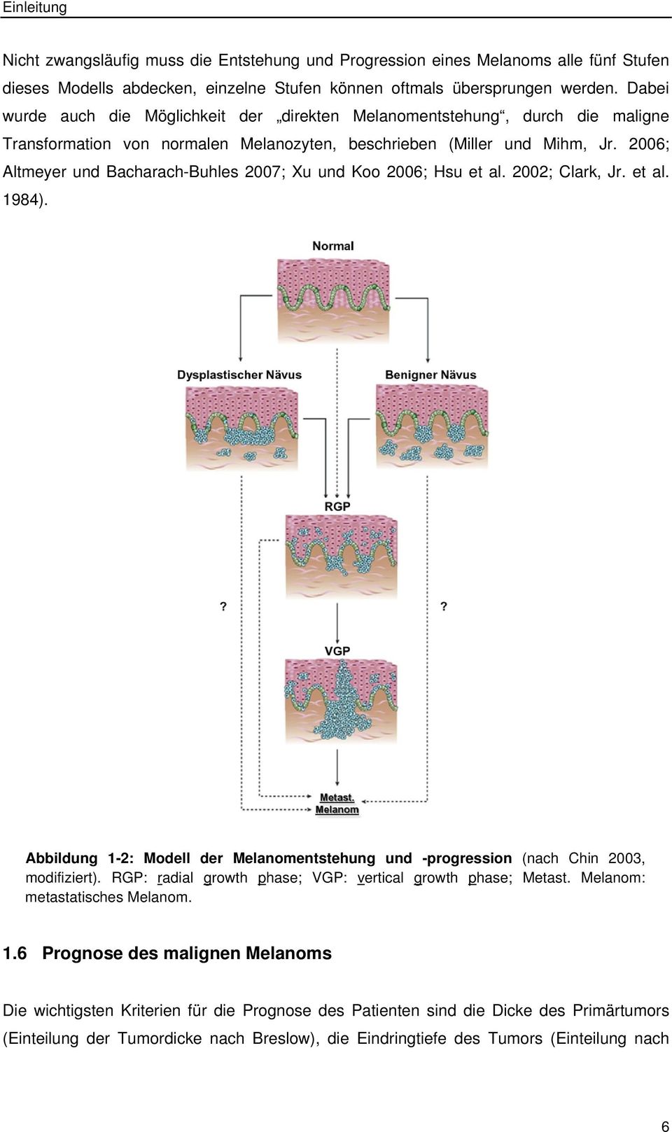 2006; Altmeyer und Bacharach-Buhles 2007; Xu und Koo 2006; Hsu et al. 2002; Clark, Jr. et al. 1984). Abbildung 1-2: Modell der Melanomentstehung und -progression (nach Chin 2003, modifiziert).