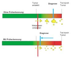 a) Typ-1-Tumore sind durch Früherkennung nachweisbar, bevor sie Metastasen bilden. c) Typ-3-Tumore metastasieren nie (oder sehr spät), sodass sie auch ohne Früherkennung geheilt werden können.