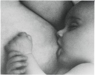 Schwangerschaftsassoziierte Form 14% aller Fälle Listeriose 2001 2002 2003 2004 2005 2006 Gesamt Schwangere 7 13 11 16 33 36 116 Neugeborene