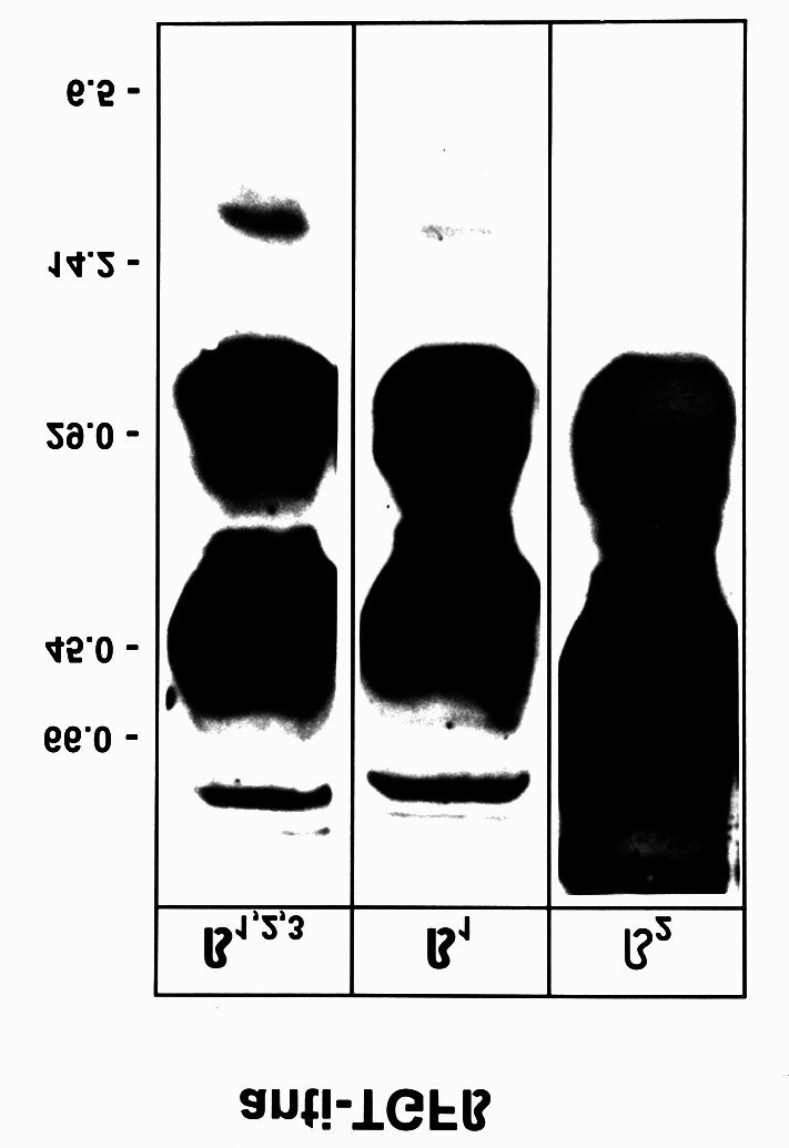 IVIG Zusätzliche Komponenten - IVIG-Präparationen enthalten TGF-ß latentes TGF-ß in IVIG (n = 238) TGF-ß1 TGF-ß2 48,62 + 4,12