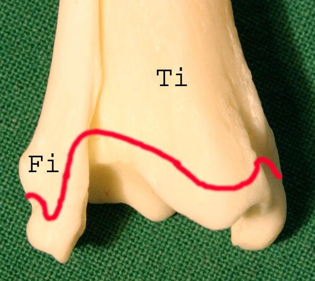 54 a) dorsale Ansicht b) laterale Ansicht c) mediale Ansicht d) plantare Ansicht Ti = Tibia, Fi = Fibula; rote