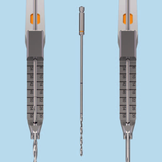 Proximale Schrauben einbringen Schraube im von der zentralen Lochachse vorgegebenen Winkel einbringen Die VA-LCP Bohrbüchse 2.7 in das VA-Verriegelungsloch einsetzen.