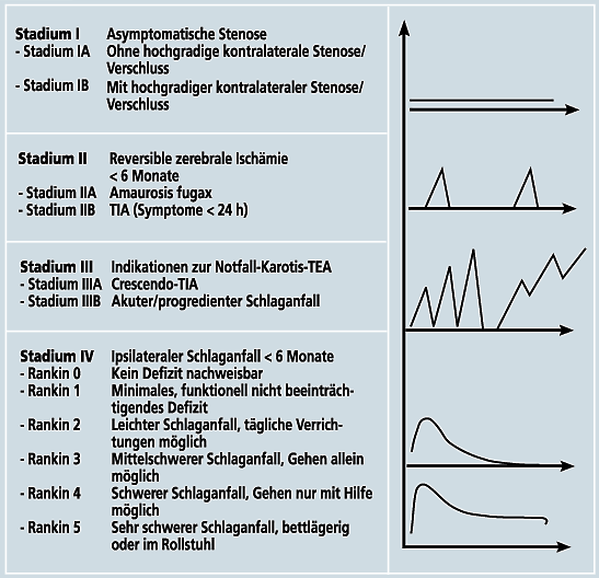 Abbildung 1: Stadieneinteilung der atherosklerotischen Karotisstenose unter Berücksichtigung der modifizierten Rankin-Skala sowie der klinischen Symptomatik (Eckstein HH, 2004) 2.