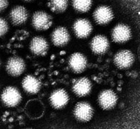 Beprobung von Oberflächengewässern Fragestellung: Bandbreite an Viruskonzentrationen Nachweis von: Adenoviren, Noroviren