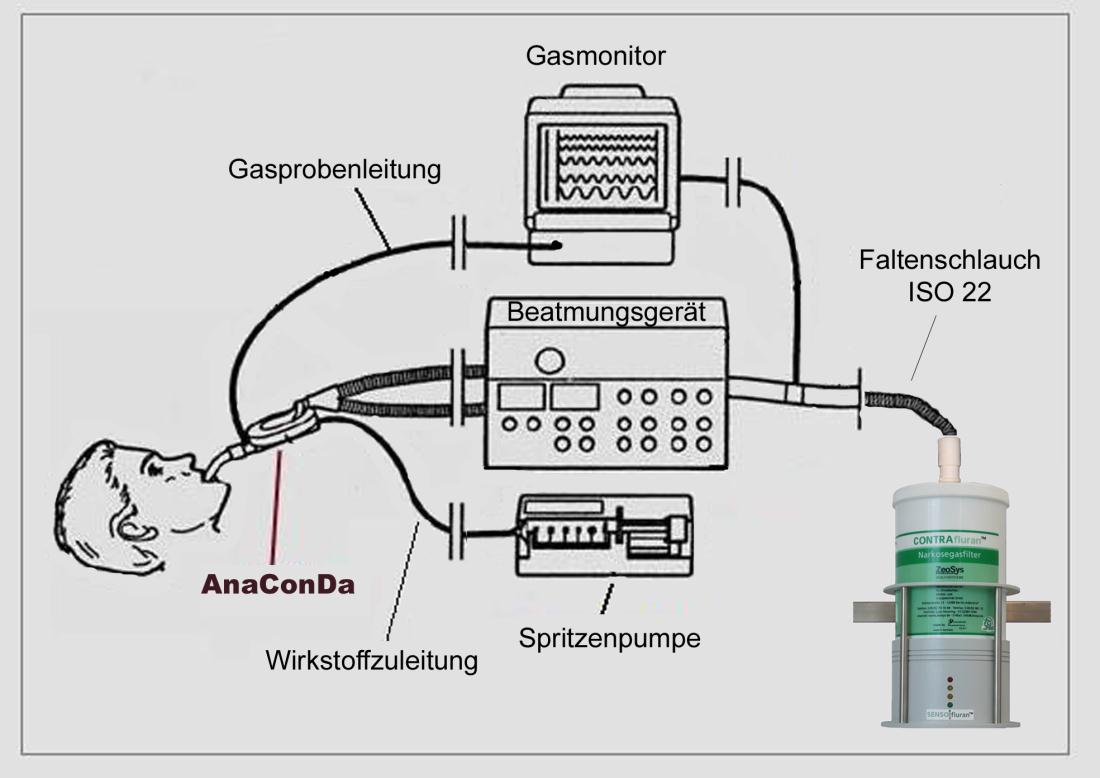 Anwendung mit dem AnaConDa -System Der CONTRAfluran TM -Restgasfilter wird mit Hilfe eines ISO 22 Faltenschlauches am Ausgang des Beatmungsgerätes angeschlossen.