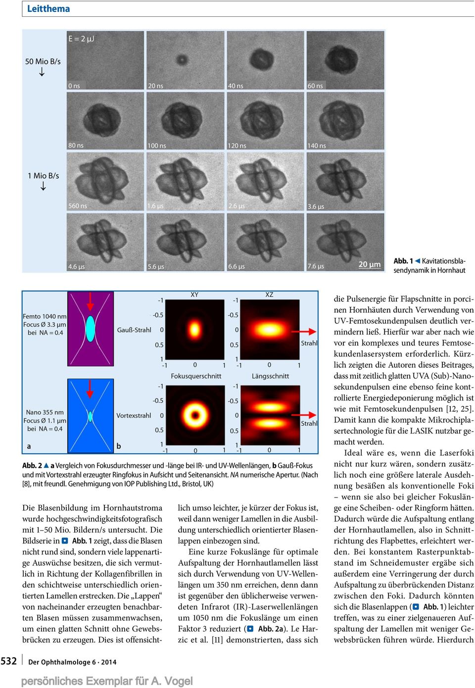(Nach [8], mit freundl. Genehmigung von IOP Publishing Ltd., Bristol, UK) Die Blasenbildung im Hornhautstroma wurde hochgeschwindigkeitsfotografisch mit 1 50 Mio. Bildern/s untersucht.