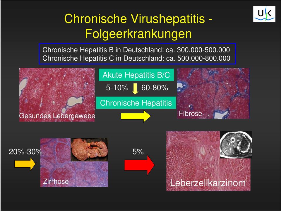 000 Chronische Hepatitis C in Deutschland: ca. 500.000-800.
