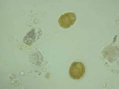 Limnologische Entwicklung - Phytoplankton von über 44 %; 1976 stellte Tabellaria fenestrata rund 2 % der Biomasse; Asterionella formosa konzentrierte ihr Biomassemaximum vor allem auf die Jahre 1998