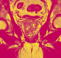 RADIOLOGISCHES SEMINAR GRAZ 2016 URORADIOLOGIE 14. 16.