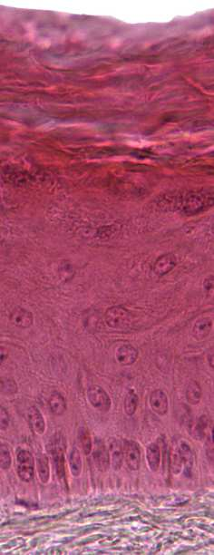1. Epidermis mehrschichtiges verhorntes Plattenepithel Keratinozyten spezielle Epithelzellen der Epidermis; durch Desmosomen verbunden; s.tem H2 und ZK2 1.5. Str.