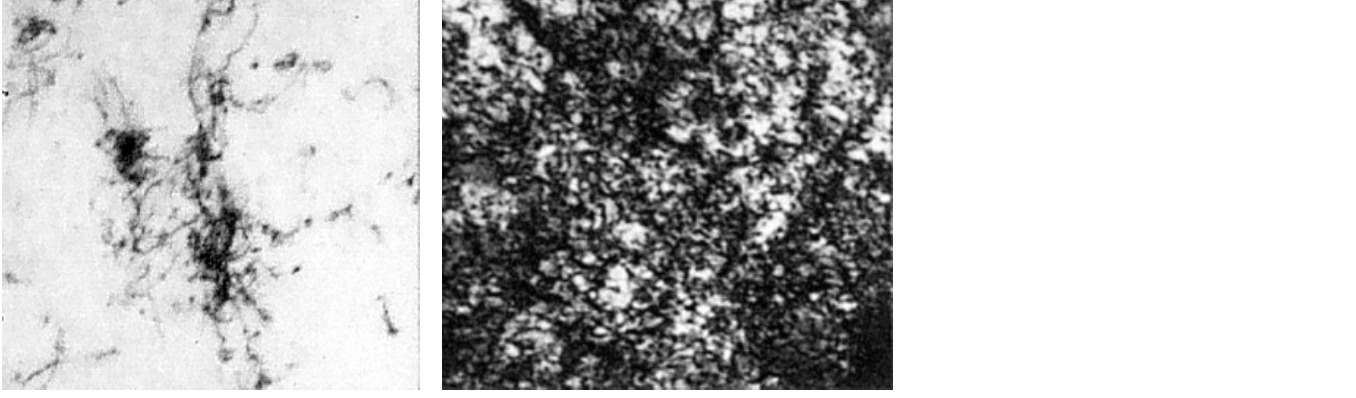 Konventionelles Kugelstrahlen - Mikrostruktur 42CrMo4, normalisiert ungestrahlt kugelgestrahlt Sintereisen kugelgestrahlt 0 P0 =13,28% 1 µm 1 µm Änderung der Porosität [%] -2-4 -6 Sintereisen -8