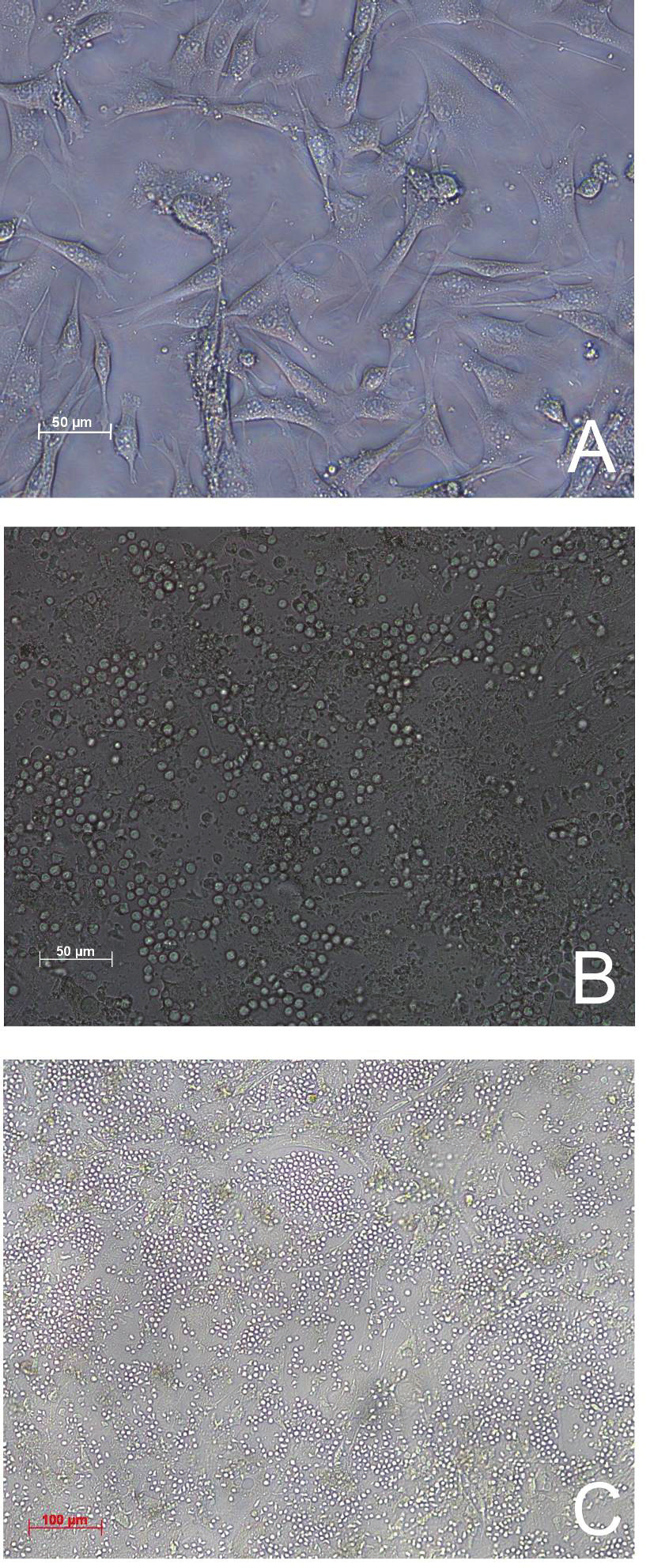 Ergebnisse Abbildung 2.5 (A) Mikroskopische Aufnahme an d0 einer NKZelldifferenzierung.
