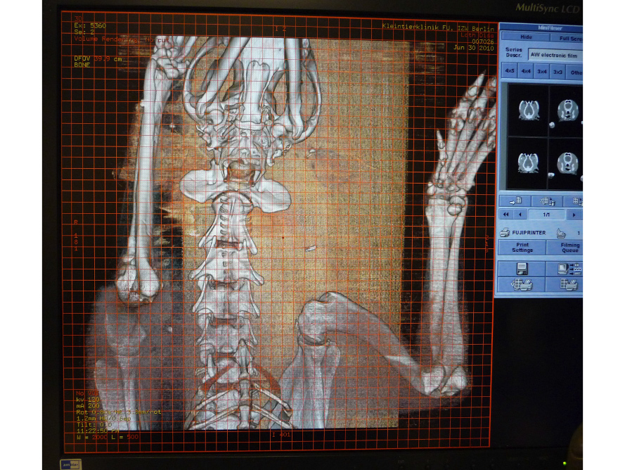 Abb. 10: Lagerung in beliebig gewählter Position, CT-Scan, ventrodorsale 3D