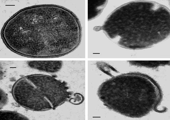 Abbildung 2: Wirkweise von antimikrobiellen Peptiden wie Defensinen. Das Bild zeigt die Inkubation von Staphylococcus aureus mit einem β-defensin (hbd-3).