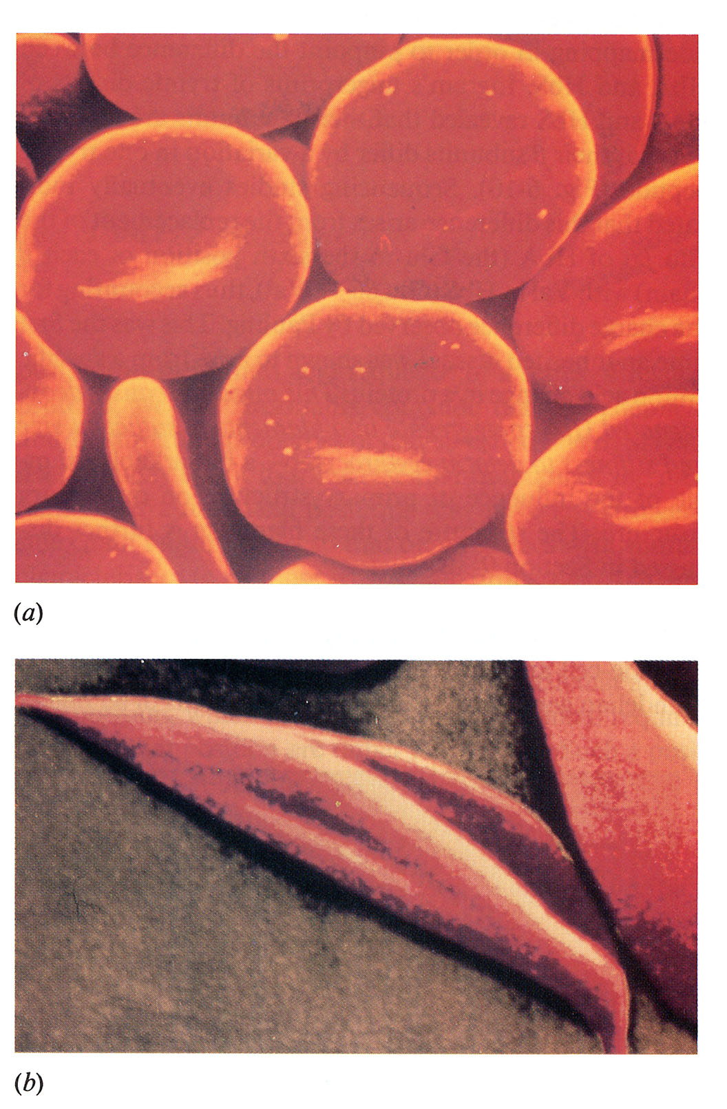 Chemische Evolution Evolution von Proteinen, Struktur <> Funktion Bsp. Sichelzellanämie: Erkrankung der roten Blutkörperchen (Erythrozyten).