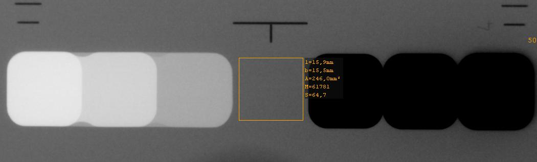 DIN 6868-13 Pixelwerte (2012) Festlegung eines ROI in Lage und Größe Der Mittelwert aller Pixelwerte dieses Messfeldes wird als charakteristischer Pixelwert berechnet und als Bezugswert für die KP