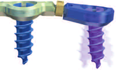 Schrauben mit variablem Winkel kranial/kaudal: 28 Bewegungs - bereich Medial/lateral: 14 Bewegungs - bereich blau 4.