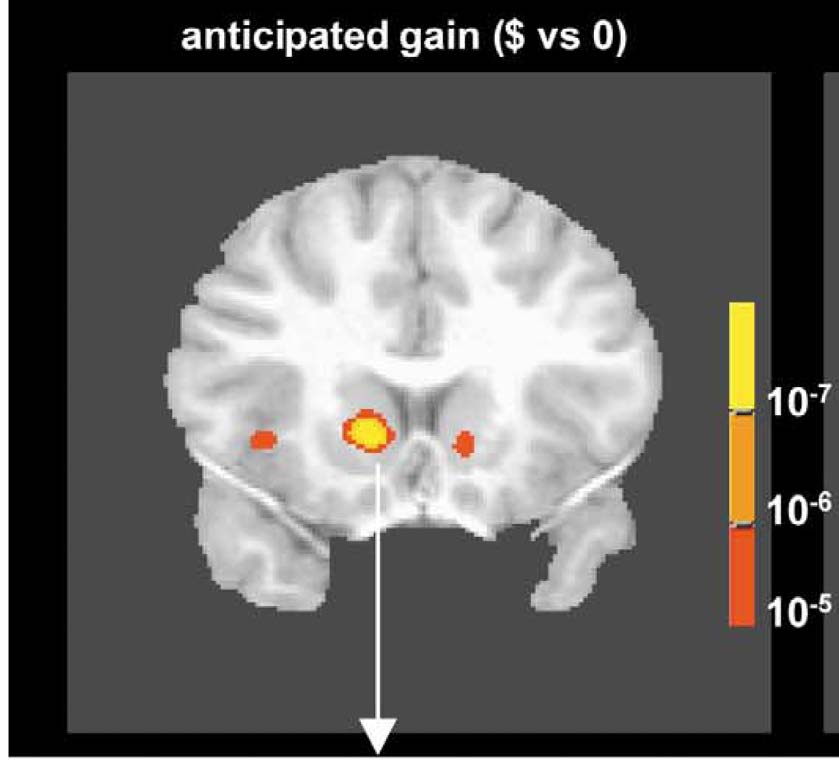 Aktivierung des mesolimbischen Systems (Nucleus accumbens) bei