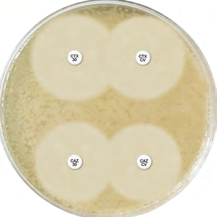 D67C Extended Spectrum β Lactamase Set () Bestätigung von ESßL-Produktion in Enterobacteriaceae ohne chromosomale dereprimierte oder induzierbare AmpC 1 CA0 2 CA0/CLAV10 3 CTX30 4 CTX30/CLAV10 5 6