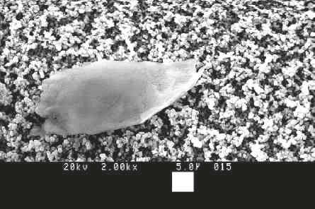 Abb. 1: Glasfragmente können beim Öffnen in die Ampulle gelangen. Größe 15 μm Größe 33 μm Größe 36 μm Größe 40 μm Abb.