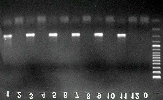 149 Anhang Tab. 8.3: Isolierte Mykobakterien-Spezies mit Hilfe der PCR in der Hauptstudie II Probenmaterialien Anzahl der Proben TBC M. avium M. chel./absc.
