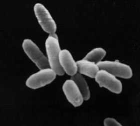 Halobacterium Gattung: Archaea Lebensraum: saline Gebiete mit Salzkonzentrationen bis zu 5.