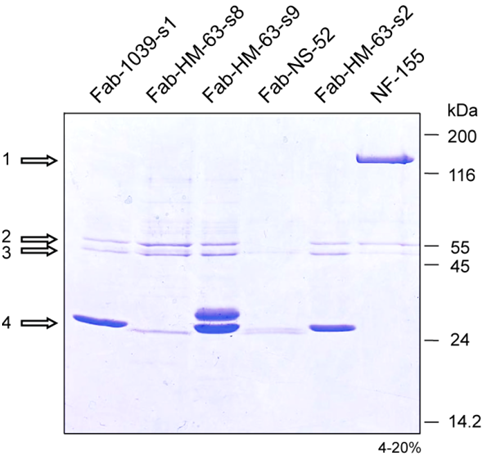 Ergebnisse 3.6.3.3 Affinitätschromatographie mit Zelllysat Ob die rfab-fragmente intrazelluläre Proteine in nativer gefalteter Form erkennen, wurde mit Affinitätschromatographie getestet.