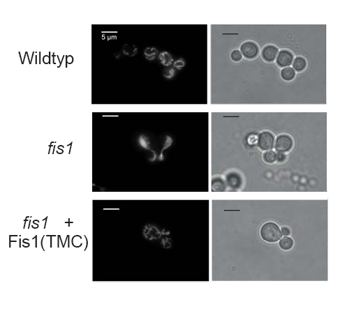 Ergebnisse Abb. 8. Fis1-TMC kann die Morphologie des fis1 Phänotyps komplementieren.