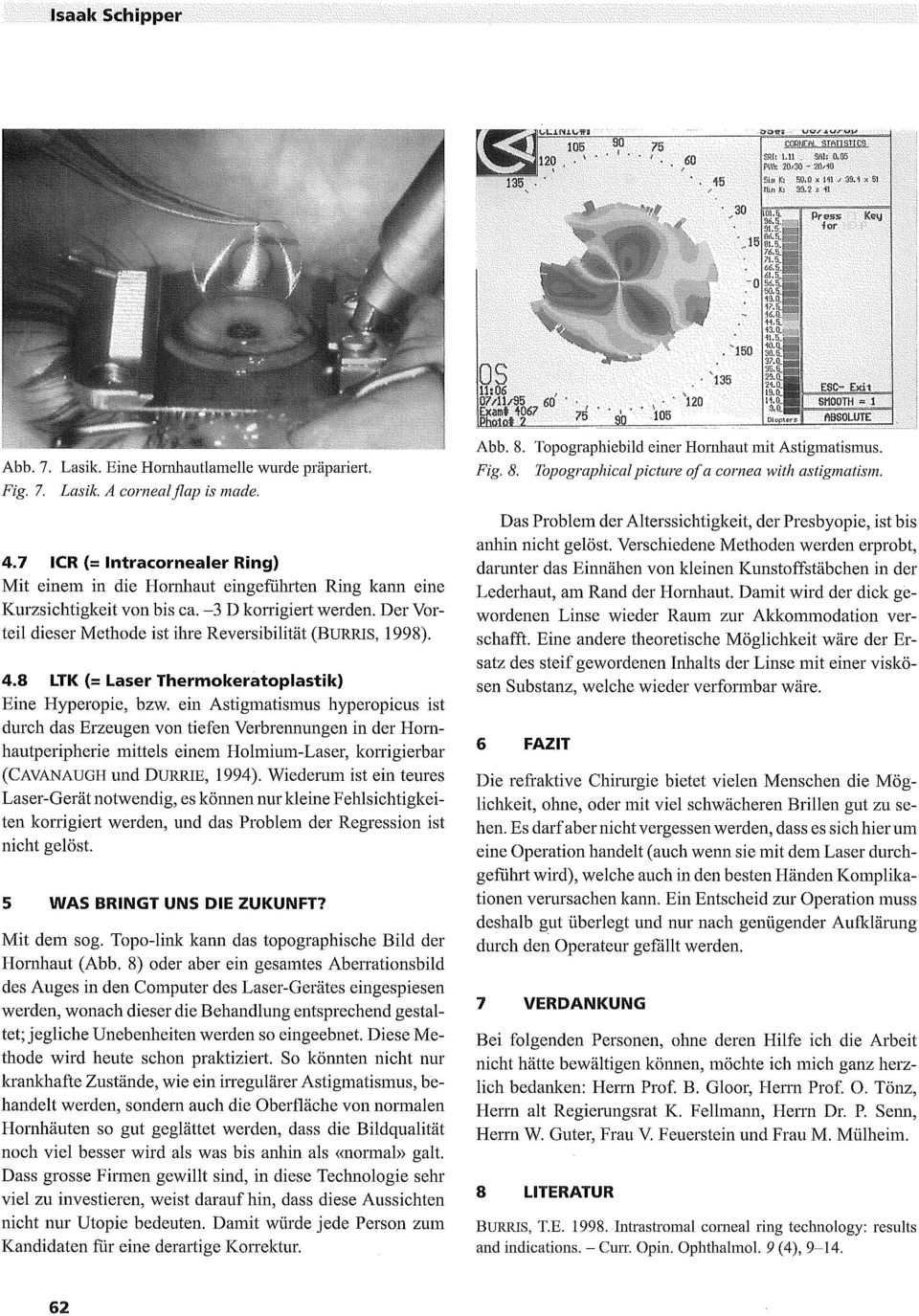 4.7 ICR (= Intracornealer Ring) Mit einem in die Hornhaut eingeführteh RiHg kahn eine Kurzsichtigkeit von bis ca. 3 D korrigiert Der Vorteil dieser Methode ist ihre Reversibilität (BURRIS, 1998). 4.