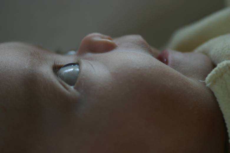 Stand des Neugeborenen-Hörscreening in Deutschland Status of neonatal screening in