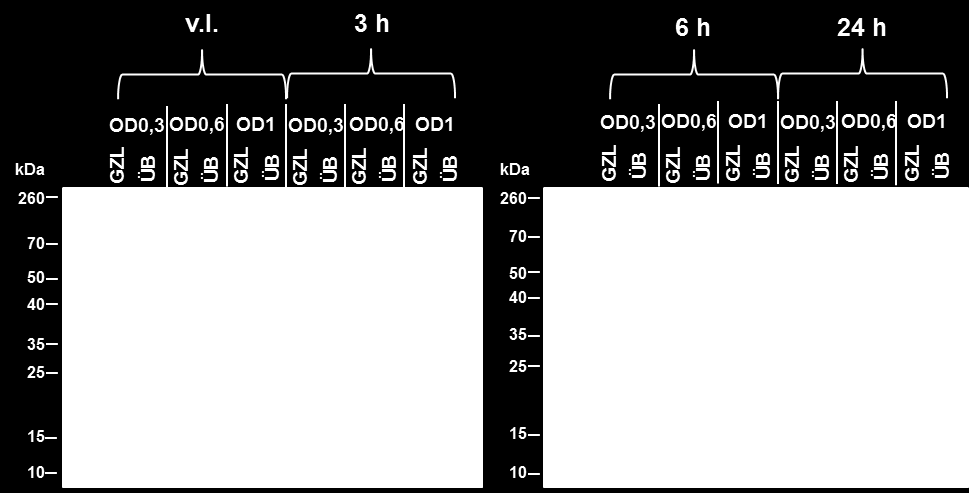 Abbildung 3: Testexpression der Acetylierungs-Mutante K129E Die Abbildung zeigt, exemplarisch für alle getesteten K129-Mutanten, die Ergebnisse der Testexpression der Acetylierungs-Mutante K129E.