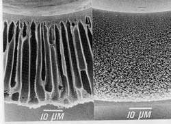 Die Niere Material und Porengröße: Cuprophan (Cellulose): sehr kleine Poren, eng wird s fürv Moleküle ab 500 Dalton, maximale Molekülgröße 1000 Dalton Celluloseacetat: anderer mikroskopischer Aufbau