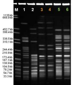 4MRGN - Verbreitungstrategien Klonale Verbreitung resistenter Bakterien-Stämme (Klone) Patient 1 Patient 2 Patient 3 DNA-Makrorestriktion + Pulsfeld-Gelektrophorese (PFGE) Unterscheidung