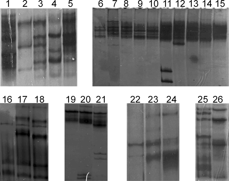 31 Abb 10: SSCP-Analyse verschiedener Mutationen (Wt Wildtyp-Kontrolle) 1: G31D 2: Wt 3: nt-12delg 4: I27L 5: A98V/nt- 12delG 6: Wt 7: H143Y 8: R159Q 9: S142P 10: A161T 11: DelN127 12: G132K 13: