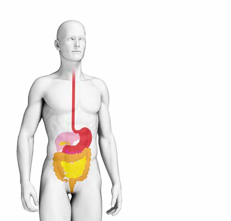Was sind Morbus Crohn und Colitis ulcerosa? Morbus Crohn und Colitis ulcerosa werden unter dem Namen «Chronisch entzündliche Darmerkrankungen» (CED) zusammengefasst.