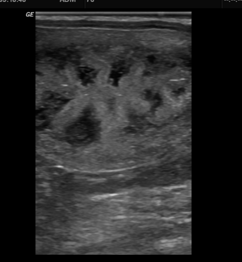 Material und Methode 3.3.2 Ultrasonographische Untersuchungen 3.3.2.1 Uterus Die Befunderhebung am Uterus erfolgte bei jeder Untersuchung im B-Modus.