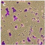 Weitere Untersuchungen mit der Zelllinie HT-29: Auch im ATP-Assay nahm der Anteil lebender Zellen durch die Inkubation mit Weizenkeimling-Extrakt von 10 mg/ml deutlich ab (Abb. 4.20).