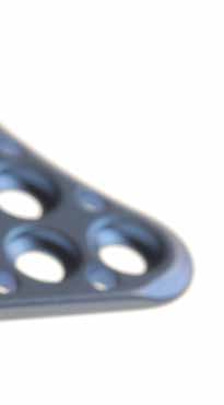 alle Plattenlöcher geeignet für winkelstabile & konventionelle Schrauben all holes suitable for locking and conventional screws * * 30 multidirektionale Winkelstabilität in allen großen