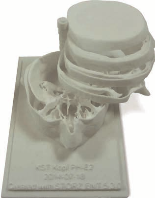 Das 3D-Modell kann dann mit Hilfe eines 3D-Druckservice ausgedruckt werden.