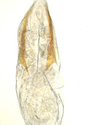 Typisch sind vor allem die Form des Ostiums, sowie die auffälligen Signa in der Bursa copulatrix, welche sie sofort sowohl von Niditinea fuscella (Linné, 1758), als auch von Niditinea striolella