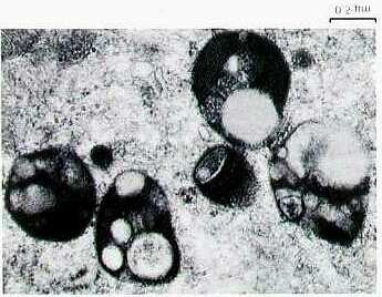Microbodies Lysosom Sind von einer einschichtigen