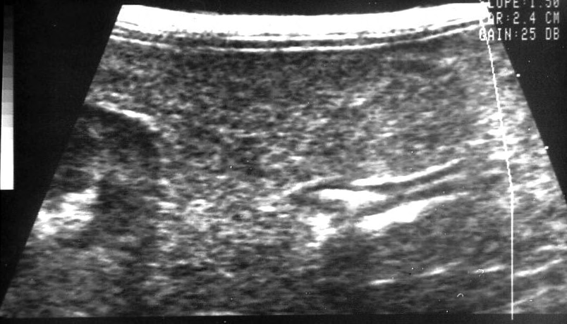 Abb. 13: Längsschnitt des unveränderten Darms einer 15 Monate alten