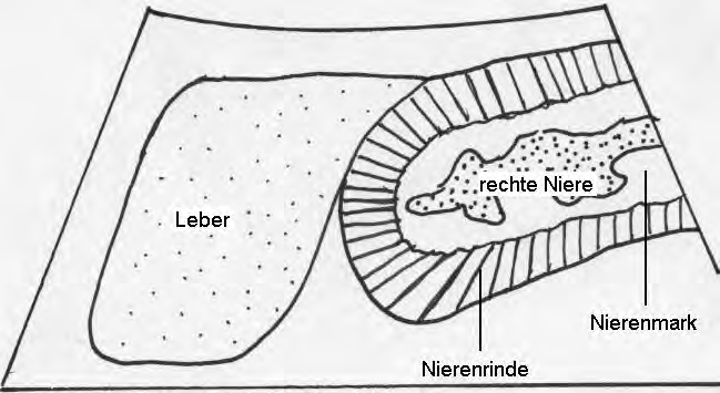 Weißen Neuseeländer-Häsin (Fall 25): Die äußerst echogene Rinde der rechten Niere hebt sich