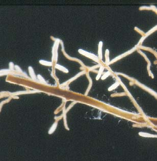 24: Mykorrhizierte Seitenwurzeln von Eichensämlingen, gewachsen auf dem unbehandelten "Kalk"(Ku)-Boden (links),