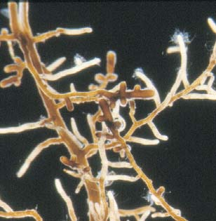 25: Seitenwurzeln von Eichensämlingen, gewachsen auf dem sterilisierten "Kalk"(Ks)-Boden (links), "Ton"(Ts)-Boden (Mitte)